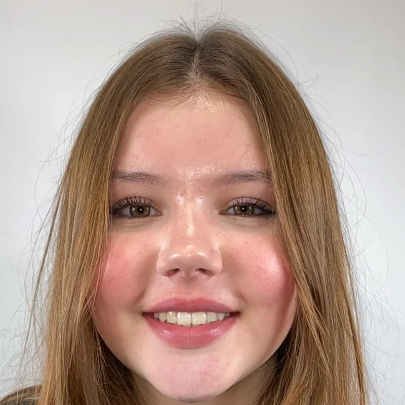 Jasmijn-na-orthodontie-behandeling
