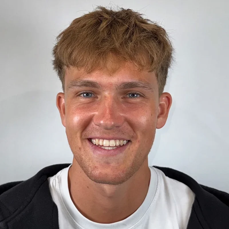 Jorn-na-orthodontie-behandeling