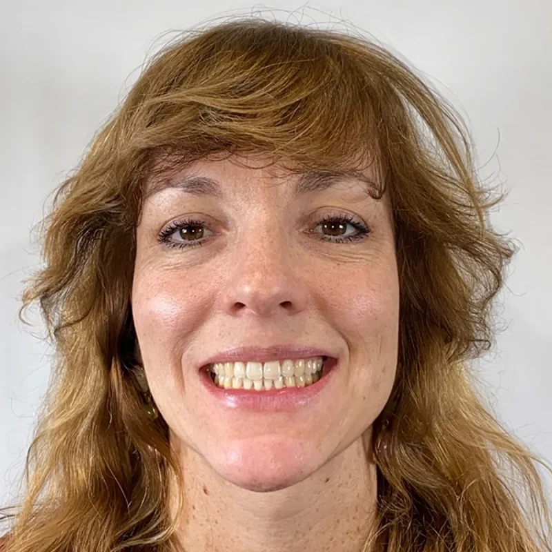Merel-na-orthodontie-behandeling
