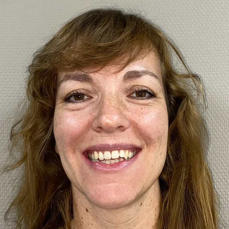 Merel-voor-orthodontie-behandeling