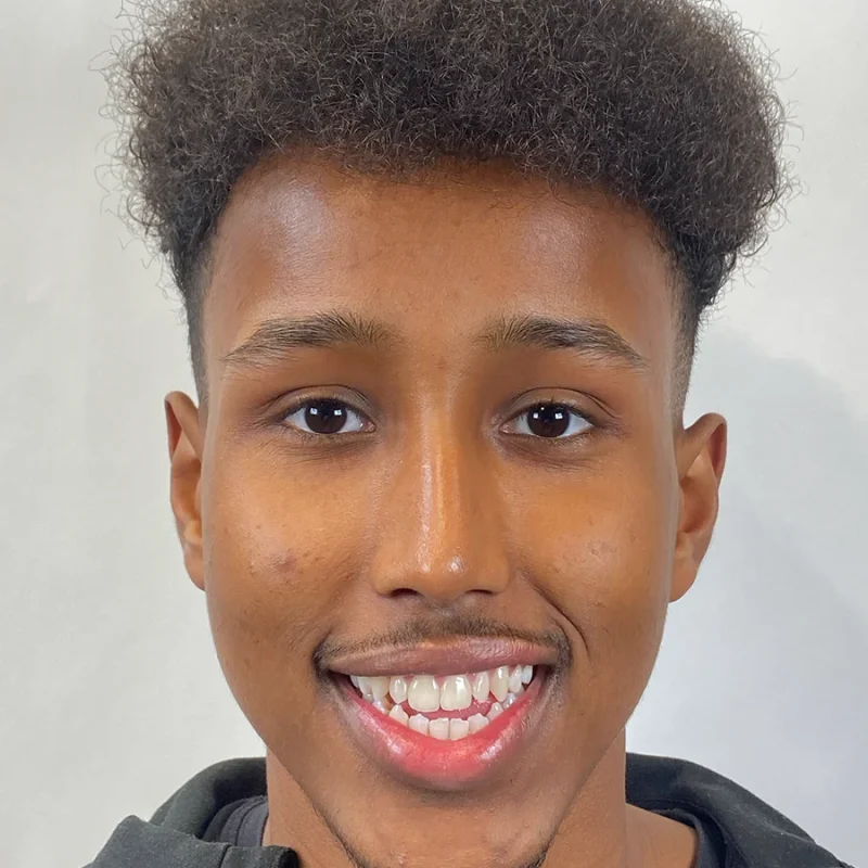 Najib-voor-orthodontie-behandeling