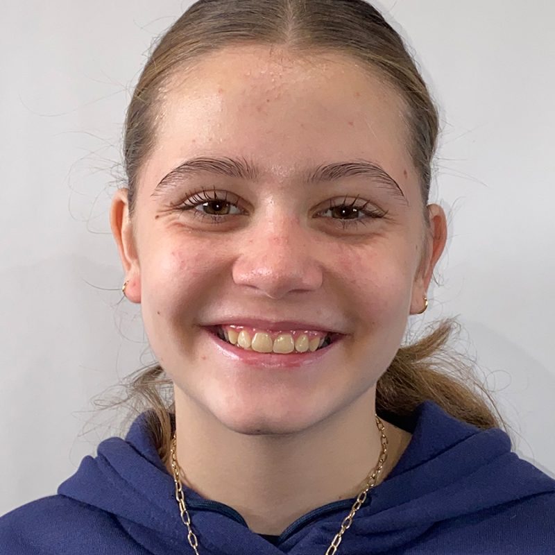 Orthodontie-beugelresultaaat-na-behandeling-voor-Sole