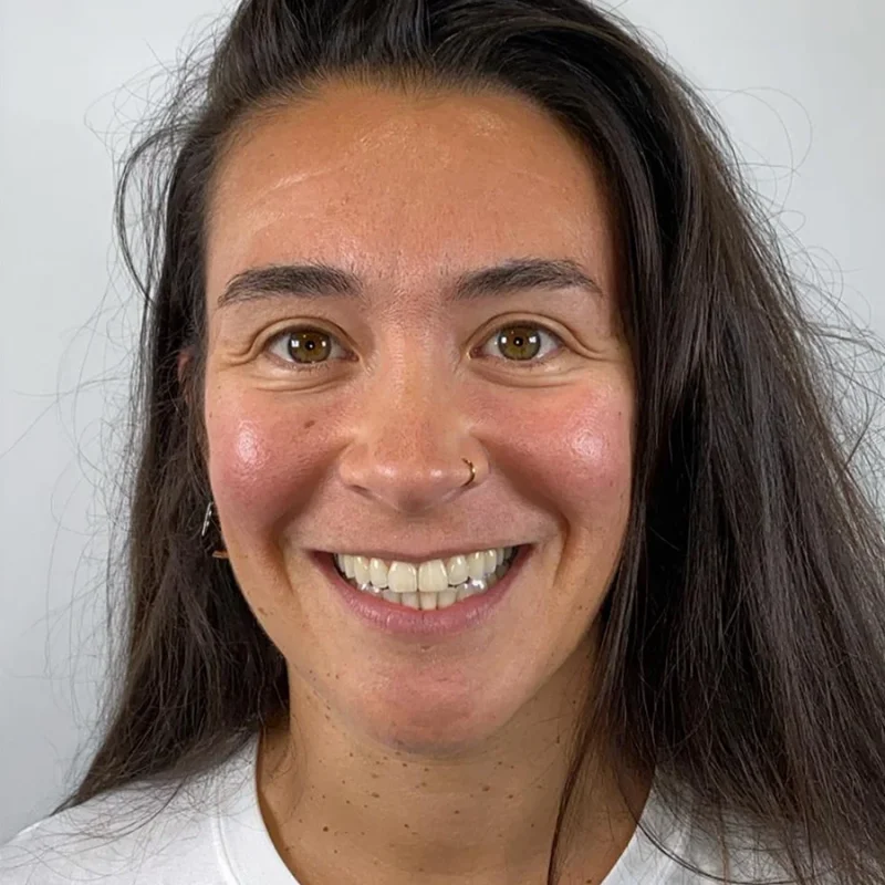 Portret-Na-Beugel-Resultaat-Claudia.webp