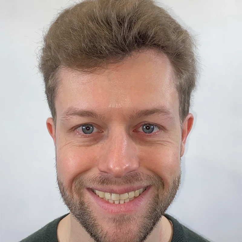 Portret-Voor-Beugel-Resultaat-Koen.webp