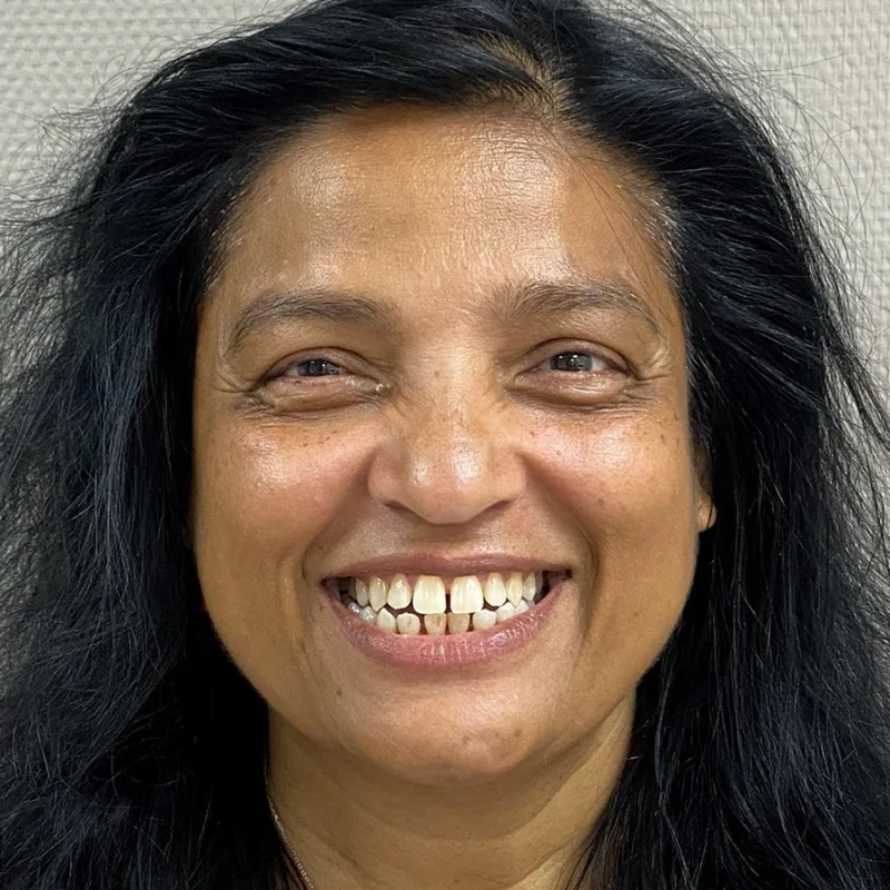 Portret-Voor-Beugel-Resultaat-Wendy