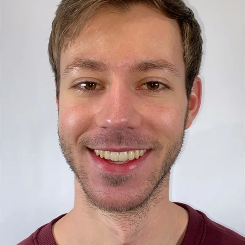 Stef-na-orthodontie-behandeling