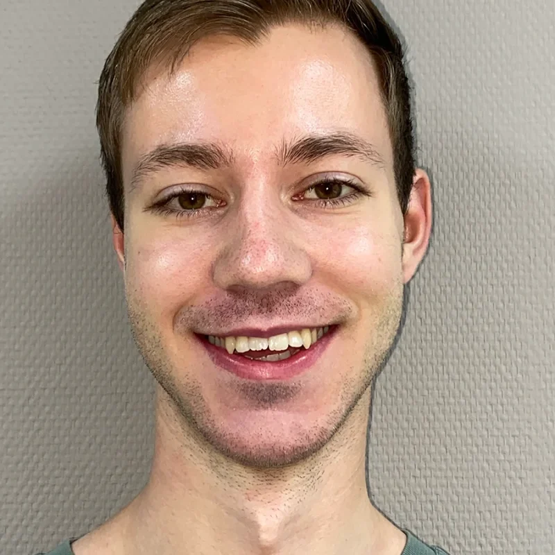 Stef-voor-orthodontie-behandeling
