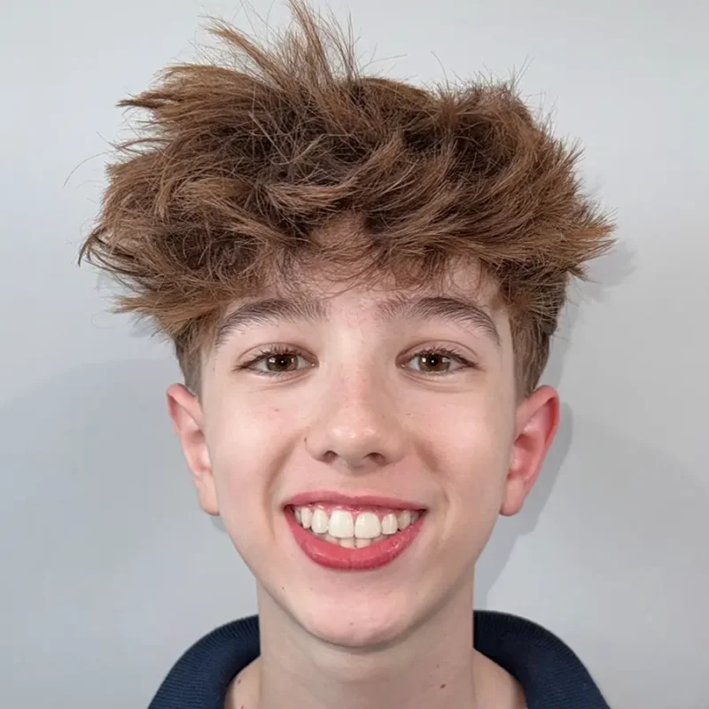 Xavi-vooraanzicht-na-orthodontie-behandeling
